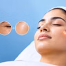 How Laser Treatments Reduce Skin Imperfections at Laser Center of Marin in Marin County